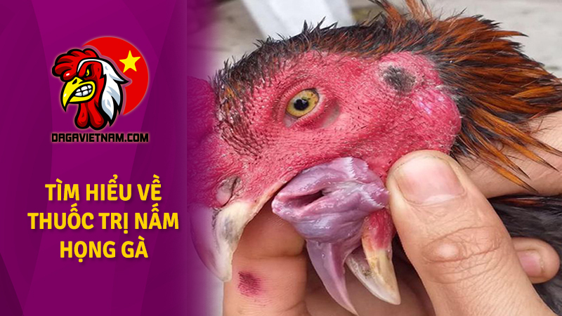 Thuốc trị nấm họng gà hiệu quả dứt điểm